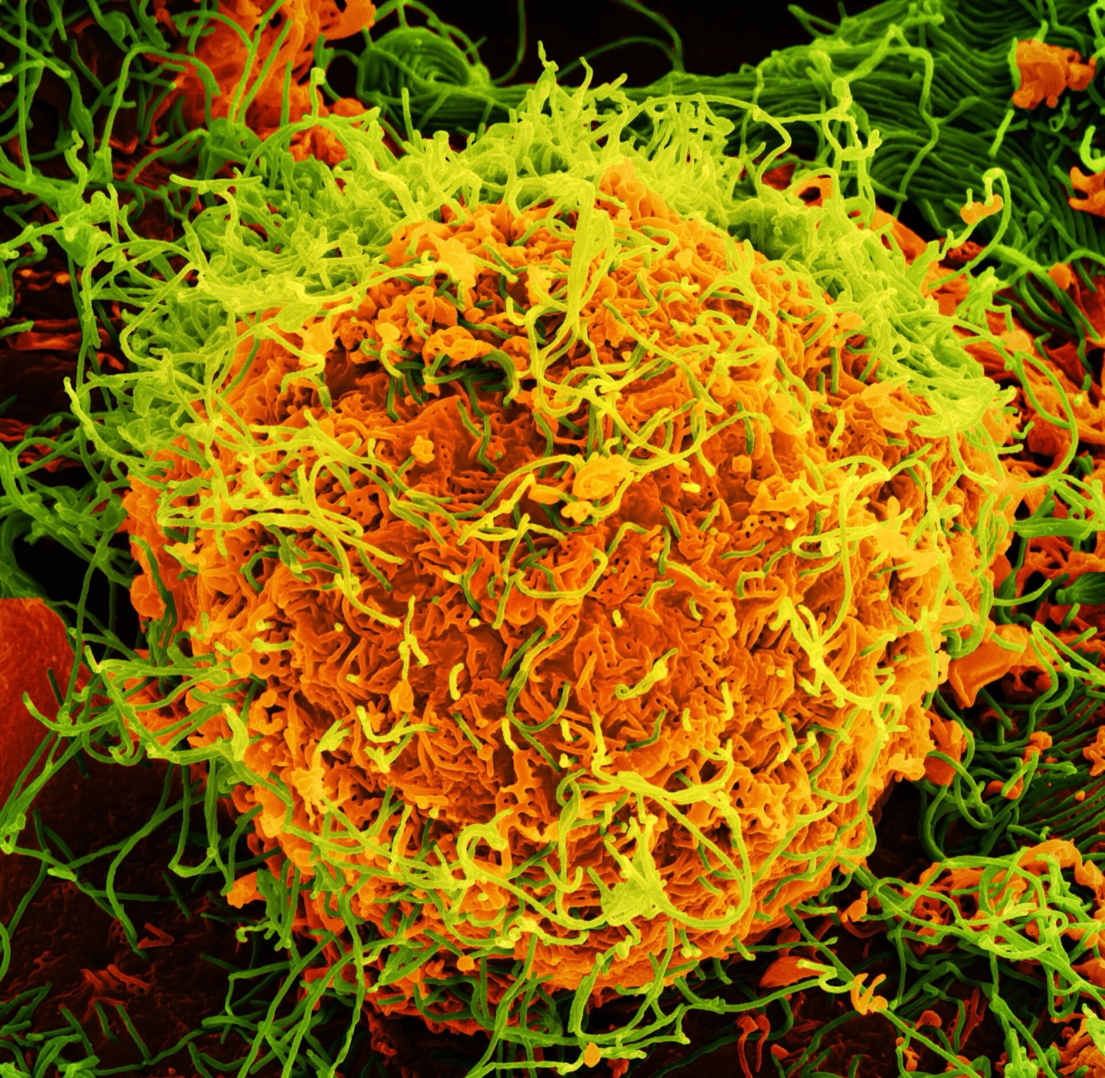 Scanning electron micrograph showing Ebola virus particles budding from the surface of infected cells. Photo: NIAID / Wikimedia Commons, CC BY 2.0