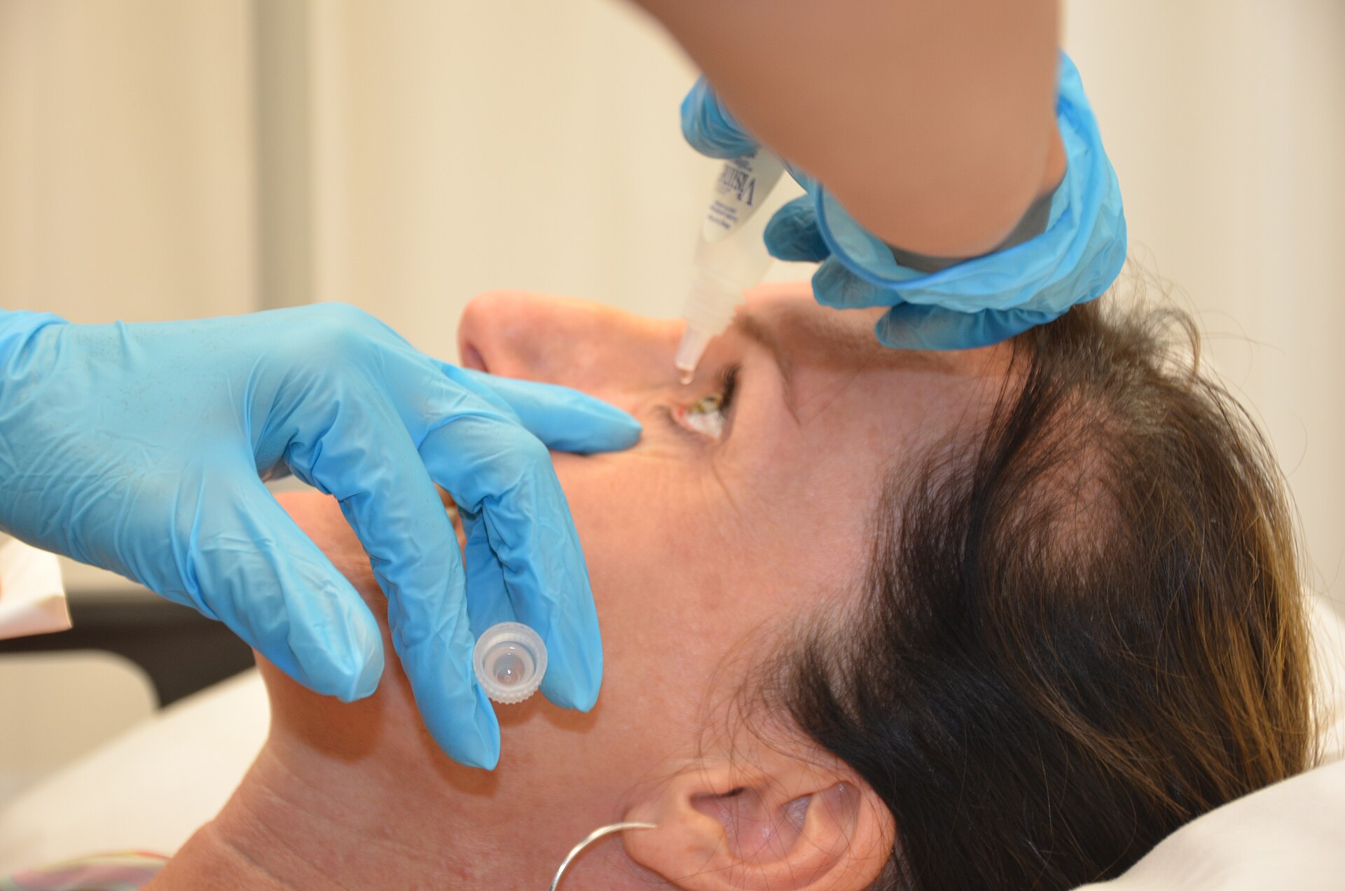 Gloved clinician instilling eye drops into a patient's lower eyelid during a nursing skills demonstration, the route at the center of the FDA sterility recall. Photo: British Columbia Institute of Technology / Wikimedia Commons, CC BY 4.0